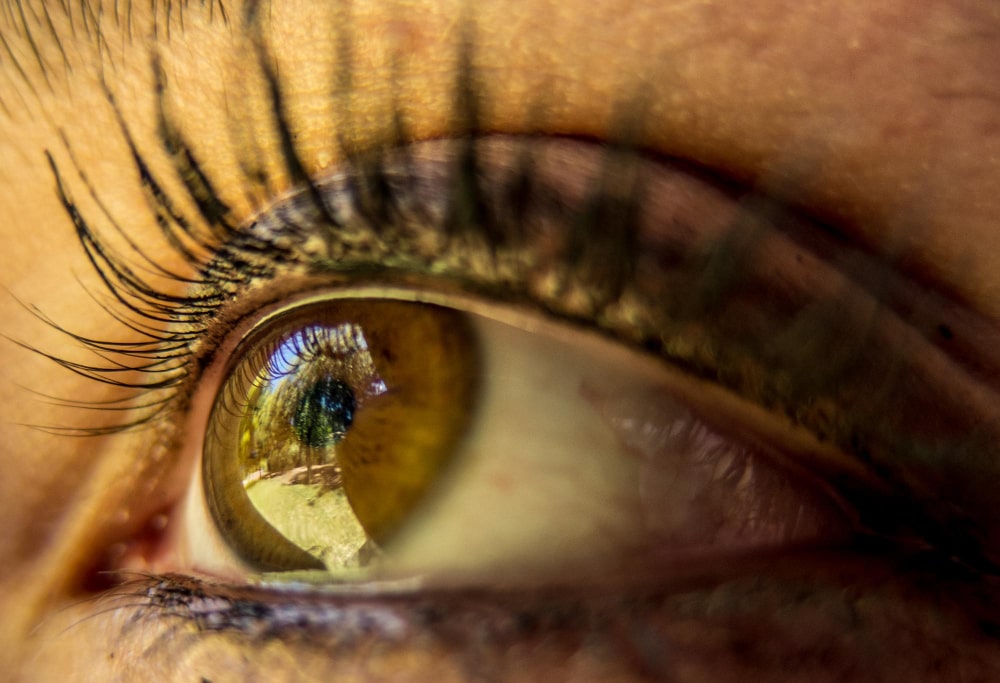 Zażółcone białka oczu - przyczyny i leczenie